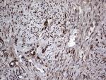 PARP1 Antibody in Immunohistochemistry (Paraffin) (IHC (P))