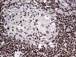 PARP1 Antibody in Immunohistochemistry (Paraffin) (IHC (P))