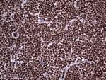 PARP1 Antibody in Immunohistochemistry (Paraffin) (IHC (P))