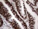 PARP1 Antibody in Immunohistochemistry (Paraffin) (IHC (P))