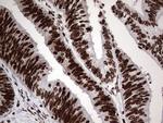 PARP1 Antibody in Immunohistochemistry (Paraffin) (IHC (P))