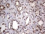 PARP1 Antibody in Immunohistochemistry (Paraffin) (IHC (P))