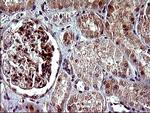 PARVA Antibody in Immunohistochemistry (Paraffin) (IHC (P))