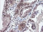 PARVA Antibody in Immunohistochemistry (Paraffin) (IHC (P))