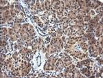 PARVA Antibody in Immunohistochemistry (Paraffin) (IHC (P))