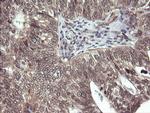 PARVA Antibody in Immunohistochemistry (Paraffin) (IHC (P))