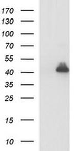 PARVA Antibody in Western Blot (WB)