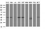 PARVA Antibody in Western Blot (WB)