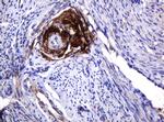 PARVB Antibody in Immunohistochemistry (Paraffin) (IHC (P))