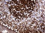 PARVB Antibody in Immunohistochemistry (Paraffin) (IHC (P))