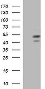 PARVB Antibody in Western Blot (WB)