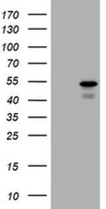 PARVB Antibody in Western Blot (WB)