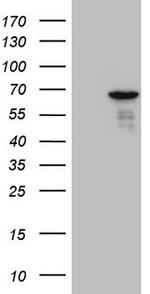 PATZ1 Antibody in Western Blot (WB)