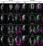 PAX3 Antibody in Immunohistochemistry (IHC)