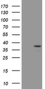 PAX4 Antibody in Western Blot (WB)