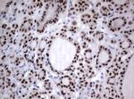 PAX5 Antibody in Immunohistochemistry (Paraffin) (IHC (P))