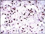 PAX5 Antibody in Immunohistochemistry (Paraffin) (IHC (P))