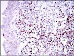 PAX5 Antibody in Immunohistochemistry (Paraffin) (IHC (P))