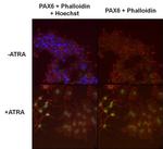 PAX6 Antibody in Immunocytochemistry (ICC/IF)