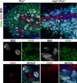 PAX6 Antibody in Immunohistochemistry (IHC)