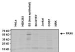 PAX6 Antibody in Western Blot (WB)