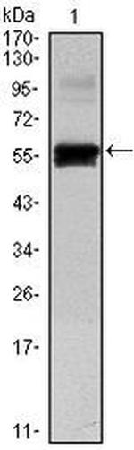 PAX6 Antibody in Western Blot (WB)