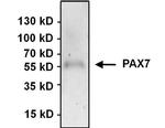 PAX7 Antibody in Immunoprecipitation (IP)