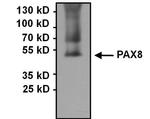 PAX8 Antibody in Immunoprecipitation (IP)