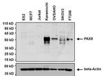 PAX8 Antibody in Western Blot (WB)