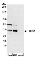 PBDC1 Antibody in Western Blot (WB)