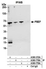 NAMPT/PBEF/Visfatin Antibody in Western Blot (WB)