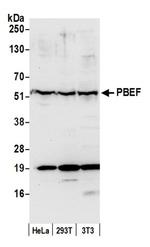 NAMPT/PBEF/Visfatin Antibody in Western Blot (WB)