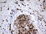 PBX1 Antibody in Immunohistochemistry (Paraffin) (IHC (P))