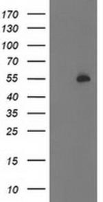 PBX1 Antibody in Western Blot (WB)