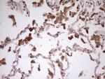 PCBP1 Antibody in Immunohistochemistry (Paraffin) (IHC (P))