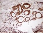 PCBP1 Antibody in Immunohistochemistry (Paraffin) (IHC (P))