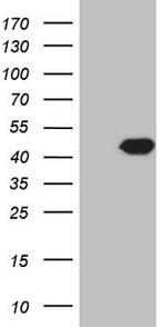 PCBP1 Antibody in Western Blot (WB)