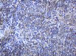 PCDH7 Antibody in Immunohistochemistry (Paraffin) (IHC (P))