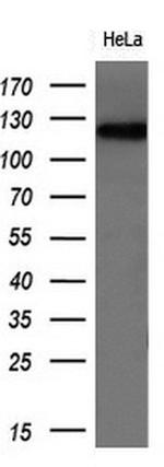 PCDH7 Antibody in Western Blot (WB)