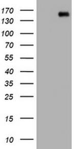 PCDH7 Antibody in Western Blot (WB)