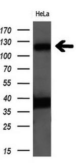 PCDH7 Antibody in Western Blot (WB)