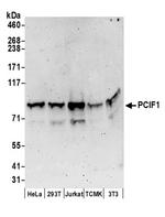 PCIF1 Antibody in Western Blot (WB)