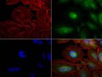 PCNA Antibody in Immunocytochemistry (ICC/IF)