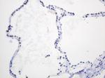 PCNA Antibody in Immunohistochemistry (Paraffin) (IHC (P))