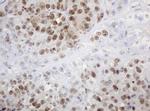 PCNA Antibody in Immunohistochemistry (Paraffin) (IHC (P))