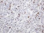 PCNA Antibody in Immunohistochemistry (Paraffin) (IHC (P))