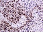 PCNA Antibody in Immunohistochemistry (Paraffin) (IHC (P))