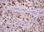 PCNA Antibody in Immunohistochemistry (Paraffin) (IHC (P))