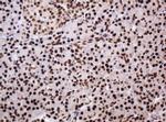 PCNA Antibody in Immunohistochemistry (Paraffin) (IHC (P))