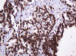 PCNA Antibody in Immunohistochemistry (Paraffin) (IHC (P))